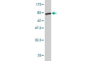 Western Blot detection against Immunogen (65. (Calreticulin 3 anticorps  (AA 21-384))