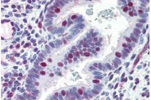 anti-Excision Repair Cross-Complementing Rodent Repair Deficiency, Complementation Group 4 (ERCC4) antibody