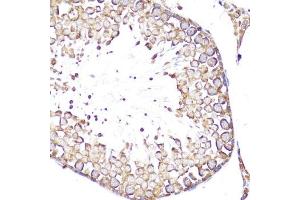 Immunohistochemistry of paraffin-embedded rat testis using SELL antibody (ABIN3022263, ABIN3022264, ABIN3022265 and ABIN6218704) at dilution of 1:100 (40x lens).