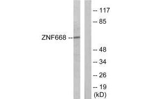 Western blot analysis of extracts from Jurkat cells, using ZNF668 antibody. (ZNF668 anticorps)