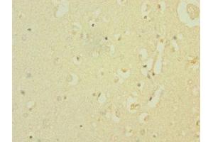 Immunohistochemistry of paraffin-embedded human brain tissue using ABIN7169927 at dilution of 1:100
