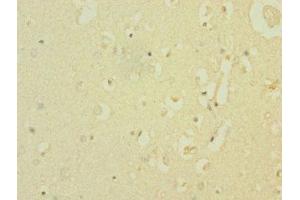Immunohistochemistry of paraffin-embedded human brain tissue using ABIN7169927 at dilution of 1:100 (SCN8A anticorps  (AA 1350-1440))