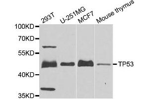 Western blot analysis of extracts of various cells, using TP53 antibody.