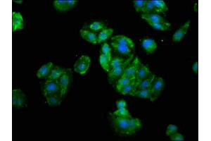 Immunofluorescence staining of HepG2 cells with ABIN7176574 at 1:133, counter-stained with DAPI. (GLI1 anticorps  (AA 921-1106))