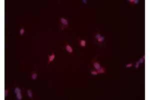 ABIN6263384 and ABIN6276526 staining HeLa cells by ICC/IF.