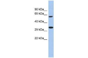FAM26A antibody used at 1 ug/ml to detect target protein. (CALHM3 anticorps  (C-Term))
