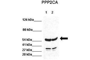 WB Suggested Anti-PPP2CA Antibody  Positive Control: Lane 1:441 µg HEK293 lysate Lane 2: 041 µg H1299 lysate Primary Antibody Dilution: 1:0000Secondary Antibody: Goat anti-rabbit-HRP Secondry  Antibody Dilution: 1:0000Submitted by: Jose Luis Rosa, Universitat de Barcelona (PPP2CA anticorps  (N-Term))