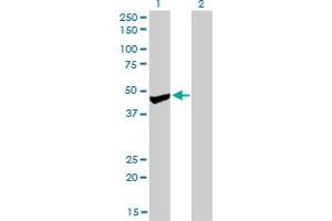 Western Blot analysis of PPM1F expression in transfected 293T cell line by PPM1F monoclonal antibody (M01), clone 2A9. (PPM1F anticorps  (AA 1-100))