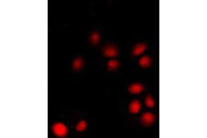 Immunofluorescent analysis of p14 ARF staining in K562 cells. (CDKN2A anticorps  (Center))