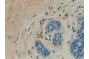 Detection of GBA in Human Mammary gland Tissue using Polyclonal Antibody to Glucocerebrosidase (GBA) (GBA anticorps  (AA 117-214))