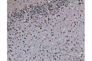 IHC analysis of PRMT5 using anti-PRMT5 antibody (ABIN7600176).