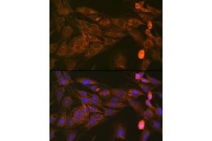 Immunofluorescence analysis of C6 cells using ST Rabbit mAb (ABIN1681118, ABIN7101700, ABIN7101701 and ABIN7101702) at dilution of 1:100 (40x lens).