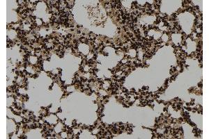 ABIN6273346 at 1/100 staining Mouse lung tissue by IHC-P.