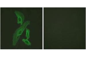 Immunofluorescence analysis of HeLa cells, using BCL-XL (Ab-47) Antibody. (BCL2L1 anticorps  (AA 13-62))