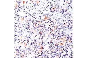 Image no. 1 for anti-Folate Hydrolase (Prostate-Specific Membrane Antigen) 1 (FOLH1) antibody (ABIN372967) (PSMA anticorps)