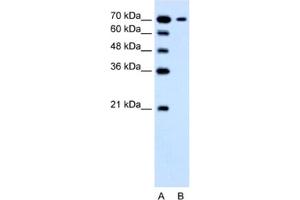 Western Blotting (WB) image for anti-Solute Carrier Family 5 (Low Affinity Glucose Cotransporter), Member 4 (SLC5A4) antibody (ABIN2462755) (SLC5A4 anticorps)