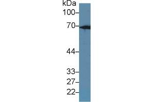 Western blot analysis of Rat Liver lysate, using Rat KRT2 Antibody (1 µg/ml) and HRP-conjugated Goat Anti-Rabbit antibody ( (Keratin 2 anticorps  (AA 508-685))
