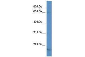 WB Suggested Anti-KCNA5 Antibody Titration: 1.