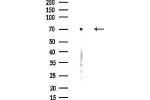 Western blot analysis of lysates from HUVEC cells(starvation,24h treatment), using ARPP21 Antibody at 1/1000 dilution.