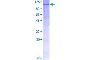 Image no. 1 for Discoidin Domain Receptor tyrosine Kinase 1 (DDR1) (AA 22-876) protein (GST tag) (ABIN1351296)