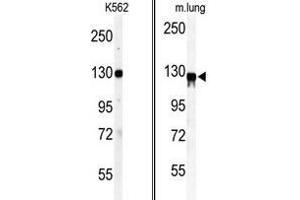 (LEFT) Western blot analysis of anti-VINC Antibody (N-term) in K562 cell line lysates (35ug/lane). (Vinculin anticorps  (N-Term))