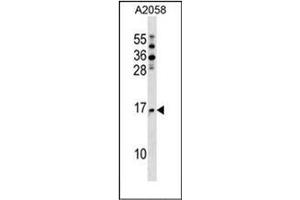Western blot analysis of NAT5 Antibody (C-term) in A2058 cell line lysates (35ug/lane). (NAT5 anticorps  (C-Term))