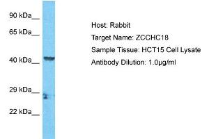 Host: Rabbit Target Name: ZCCHC18 Sample Tissue: Human HCT15 Whole Cell  Antibody Dilution: 1ug/ml (ZCCHC18 anticorps  (C-Term))