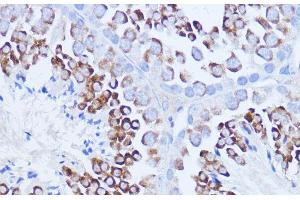 Immunohistochemistry of paraffin-embedded Mouse testis using Polyclonal AntibodyPC1 Polyclonal Antibody at dilution of 1:100 (40x lens). (PC1 anticorps)