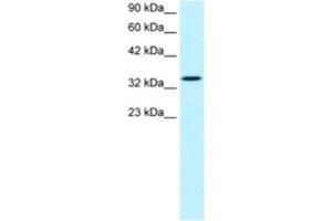 Western Blotting (WB) image for anti-SMAD, Mothers Against DPP Homolog 6 (SMAD6) antibody (ABIN2460536) (SMAD6 anticorps)