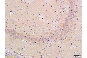 Formalin-fixed and paraffin-embedded rat hippocampus labeled with Rabbit Anti-OPN Polyclonal Antibody, Unconjugated (ABIN723800) at 1:300 followed by conjugation to the secondary antibody (Osteopontin anticorps  (AA 221-280))
