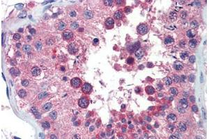 Human Testis (formalin-fixed, paraffin-embedded) stained with ZNF165 antibody ABIN462198 followed by biotinylated goat anti-rabbit IgG secondary antibody ABIN481713, alkaline phosphatase-streptavidin and chromogen. (ZNF165 anticorps  (AA 216-265))