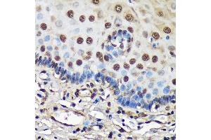 Immunohistochemistry of paraffin-embedded Human esophageal using FCF1 Rabbit pAb (ABIN7267162) at dilution of 1:100 (40x lens). (FCF1 anticorps)