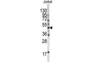 Western blot analysis of HFE antibody (Center) in Jurkat cell line lysates (35 µg/lane). (HFE anticorps  (Middle Region))