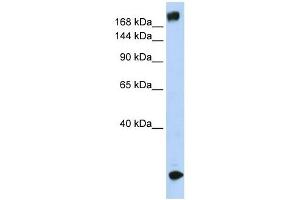 SCN5A antibody used at 1 ug/ml to detect target protein.