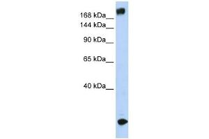 SCN5A antibody used at 1 ug/ml to detect target protein. (SCN5A anticorps  (N-Term))