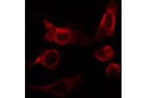 ABIN6266795 staining HepG2 cells by IF/ICC. (RHOBTB2 anticorps)