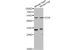 Western blot analysis of extracts of various cell lines, using DCN Antibody (ABIN5970829) at 1/1000 dilution. (Decorin anticorps)