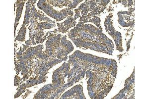 IHC analysis of EEF2 using anti-EEF2 antibody (ABIN7603141). (EEF2 anticorps  (N-Term))