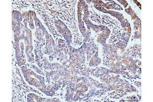 IHC analysis of GIT1 using anti-GIT1 antibody (ABIN7601683). (GIT1 anticorps  (AA 415-736))