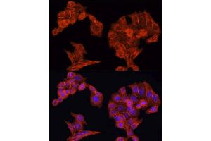 Immunofluorescence analysis of HeLa cells using EGFR antibody. (EGFR anticorps  (AA 1021-1210))
