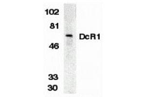 Western Blotting (WB) image for anti-Tumor Necrosis Factor Receptor Superfamily, Member 10c (TNFRSF10C) (Extracellular Domain) antibody (ABIN1030834) (DcR1 anticorps  (Extracellular Domain))