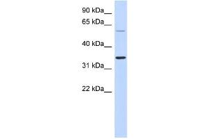 WB Suggested Anti-SASP Antibody Titration: 0. (ASPRV1 anticorps  (Middle Region))