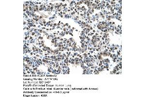 Rabbit Anti-AGER Antibody  Paraffin Embedded Tissue: Human Lung Cellular Data: Alveolar cells Antibody Concentration: 4. (RAGE anticorps  (C-Term))