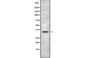 Western blot analysis OR4C12 using HuvEc whole cell lysates (OR4C12 anticorps  (Internal Region))