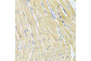 Immunohistochemistry of paraffin-embedded rat heart using GLRX Antibody (ABIN1876503) at dilution of 1:200 (40x lens). (Glutaredoxin 1 anticorps)