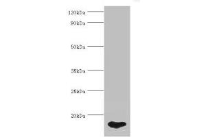 Western blot All lanes: FABP5 antibody at 5 μg/mL + HepG2 whole cell lysate Secondary Goat polyclonal to rabbit IgG at 1/10000 dilution Predicted band size: 15 kDa Observed band size: 15 kDa (FABP5 anticorps  (AA 1-135))