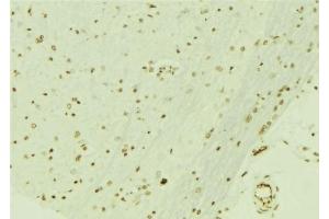 ABIN6276692 at 1/100 staining Mouse brain tissue by IHC-P.