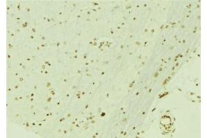 ABIN6276692 at 1/100 staining Mouse brain tissue by IHC-P. (Retinoblastoma Binding Protein 4 anticorps  (C-Term))