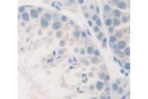 Figure. (SEMA5B anticorps  (AA 36-161))