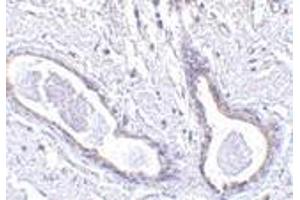 Immunohistochemistry of CCDC98 in human breast tissue with CCDC98 antibody at 5 μg/ml. (CCDC98 anticorps  (N-Term))